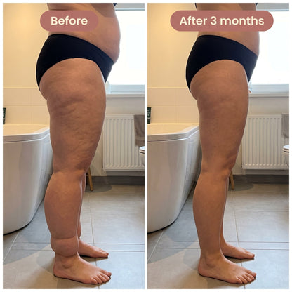 Sculpt 4D Lipedema Leggings